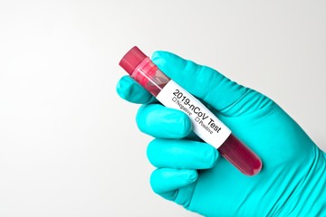 Unrecognizable person holding a 2019-nCoV Coronavirus Test Tube. 