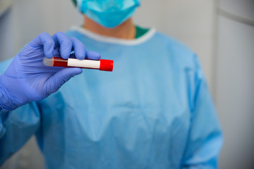 Doctor o enfermera mostrando o haciendo test de sangre con motivo de la pandemia a nivel mundial llamada COVID-19 o Coronavirus.


