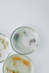 Viruses and bacteria in a Petri dish, studying the growth of bacteria on different samples in the laboratory.