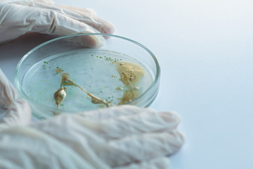 Research of viruses and bacteria, researcher holds a Petri dish with a sample.