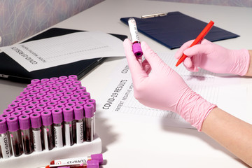The doctor in pink medical gloves holds a test tube in his hand with a positive test result for COVID-19 and notes in the report of positive patients