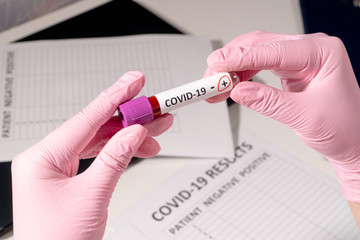 Obraz premium Doctor in pink medical gloves holds test tubes with blood for analysis of virus COVID-19