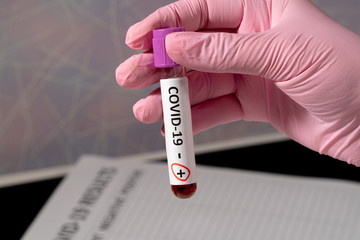 Doctor in pink medical gloves holds test tubes with blood for analysis of virus COVID-19