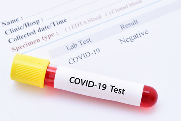 COVID-19 negative result with blood sample tube