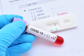 Positive test result by using rapid test device for COVID-19 virus