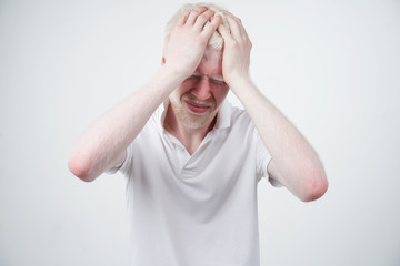 portrait of an albino man in studio dressed t-shirt isolated on a white background. abnormal...