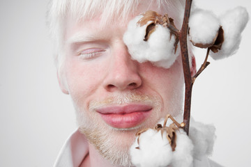 portrait of an albino man in studio dressed t-shirt isolated on a white background. abnormal...