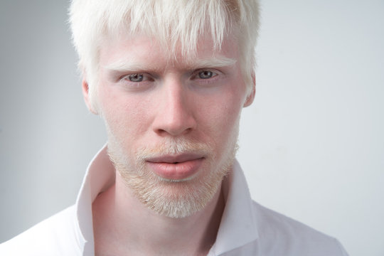 portrait of an albino man in studio dressed t-shirt isolated on a white background. abnormal deviations. unusual appearance