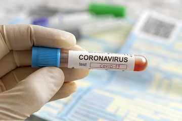 Nurse Holding A Positive Blood Test Result For The New Rapidly Spreading Coronavirus, Originating In
