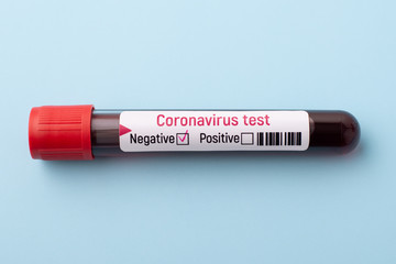 Test tube with negative result of coronavirus on blue background. End of coronavirus lockdown