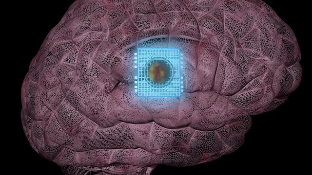 Glowing Implant inside human head.  Brain implant . 3d animation