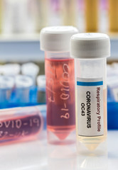 Vials with samples of SARS-COV-2 Covid-19 in a research laboratory, conceptual image