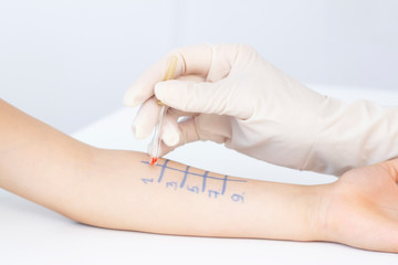 Allergen test on hand. child undergoing procedure of allergen skin test in clinic.