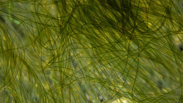 Green algae of the cyanobacteria Oscillatoria under the microscope, the family Oscillatoriaceae, the threads in the colonies can slide and move to the light source for photosynthesis. It is believed t