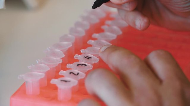 laboratory, laboratorio, covid, covid19, experiment, experimento, 4k, gh5, science, safety, salud, salud p&uacute;blica, medicina, pipette, pipeta, pipeteo
