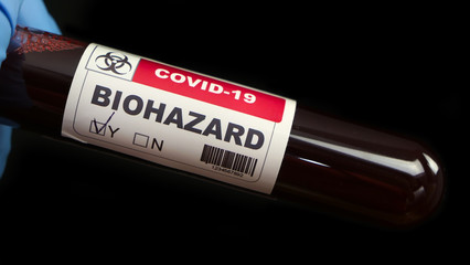COVID-19 positive blood sample tube contaminated by Coronavirus
