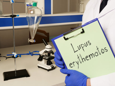 Lupus erythematosus is shown on the conceptual medical photo
