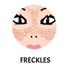 Freckles on the face. Pigmentation on the skin. A pigmented spot on the skin of the face. Vector illustration