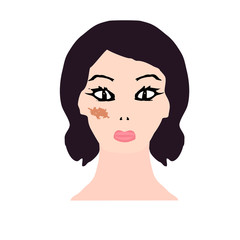 Pigmentation on the skin. A pigmented spot on the skin of the face. Vector illustration