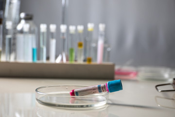 Positive blood test result for the new rapidly spreading Coronavirus, originating in Wuhan, China