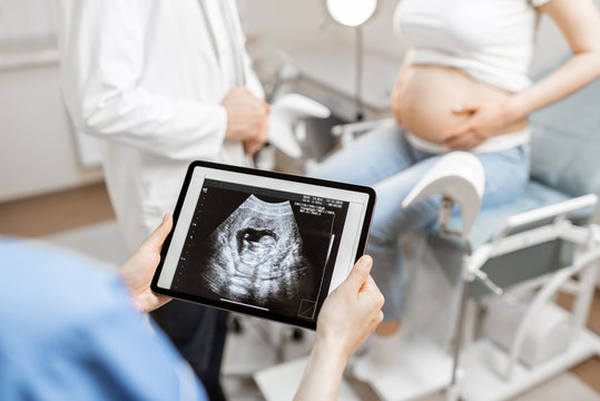 Medics with an ultrasound scan of unborn child on a digital tablet during an examination with a pregnant woman in the office, cropped view without faces