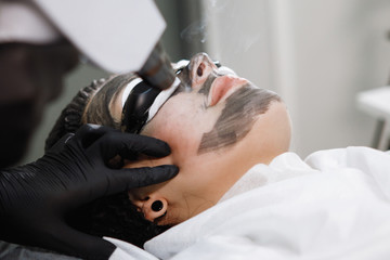 Laser carbon peeling procedure for face skin.