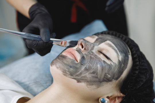 Laser carbon peeling procedure for face skin.