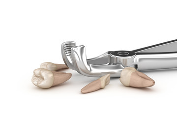 Extraction forceps and teeth, concept 3D illustration.