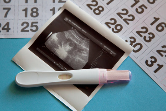 Ultrasound scan of an unborn baby of fifth week with a pregnancy test and calendar on the blue background. Pregnancy concept. 