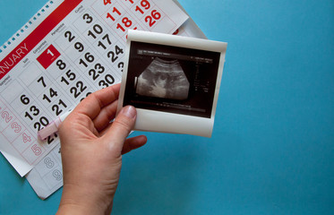 Person holding an ultrasound scan on the blue background. Being pregnant concept. Healthcare concept. 