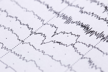 Cardiogram on a sheet of paper close-up. Texture of pulsed waves.