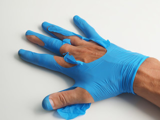 Medical torn glove in hand on white background..
