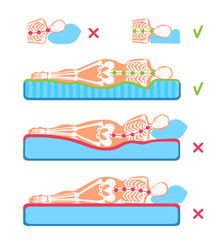 A woman lying on her side on the orthopedic mattress and pillow. A human body silhouette with a skeleton. Good and bad posture, position. Spine and head support. A comparison illustration.