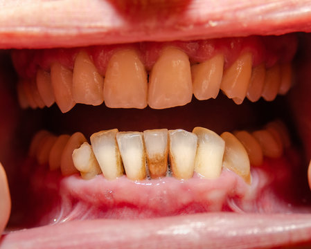 Oral cavity, groomed teeth with signs of periodontal disease.