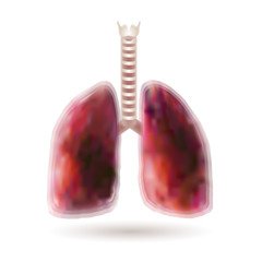Inflamed respiratory system, showing the diseases of the human lung