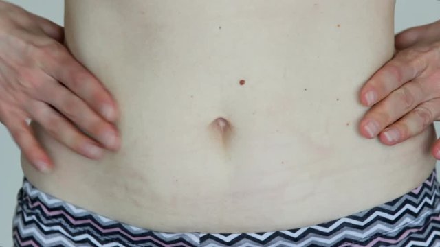 Close up of young woman pinching her belly fat. Overweight