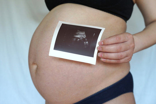 the baby in the picture is ultrasound and in the pregnant belly