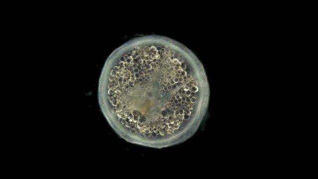 coral larva under a microscope, Order: Actiniaria, Phylum: Cnidaria, adult stage, an rictus has already formed, will soon sink to the bottom and turn into a coral polyp