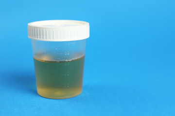 Urine sample in container on a blue background