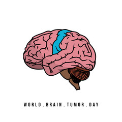 Vector Illustration of Brain with brain tumor concept design