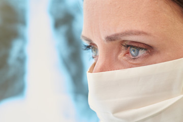 A doctor looks at radiographs of a patient with pneumonia