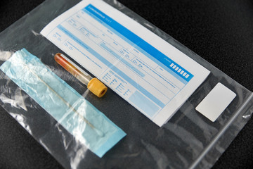 medicine, healthcare and pandemic concept - beaker with test, cotton swab and medical report in plastic zipper bag