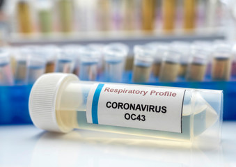 Vials with samples of SARS-COV-2 Covid-19 in a research laboratory, conceptual image