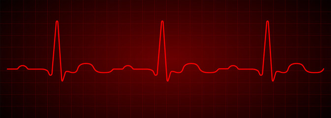 Heartbeat line. Red electrocardiogram. Vector pulse line. Medical cardiogram on grid background.