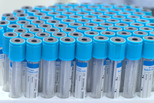 Close-up And Selective Focus A Group Of Blue Sample Tube, Sample Tube For Keep Blood Of Patient For Diagnose On Laboratory, Medical Equipment