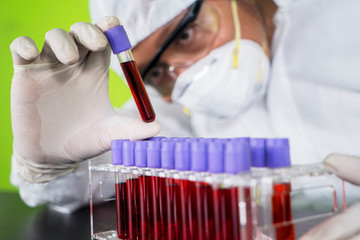 Scientist with coronavirus blood sample