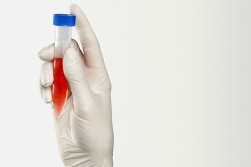 Coronavirus.