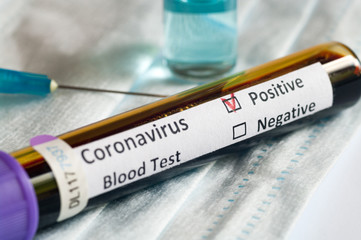 Blood sample tube positive with COVID-19 or novel coronavirus SARS-CoV-2