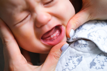 First milktooth and crying baby close up. Newborn tantrum child on mother hands. Family life,...