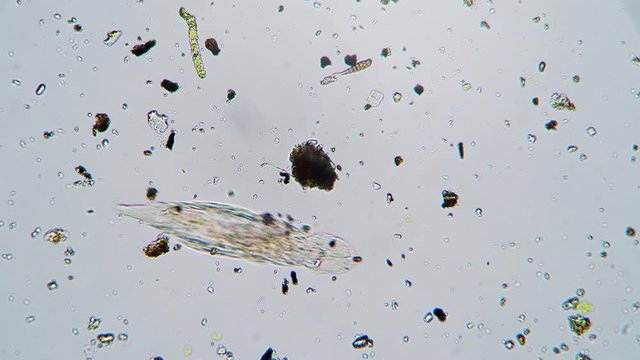 The small rotifier is moving over the field with other animals under the microscope. Tiny protostome is crawling over the area of life. Theme of the small animals and creatures in microcosmos.